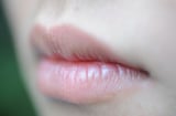 8 dấu hiệu bất thường ở môi cảnh báo Sh88bet đăng ký miễn phí bạn đang có vấn đề