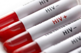 Vụ hàng loạt người trong làng bỗng nhiễm HIV: Nam bác sĩ lên tiếng trần tình