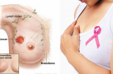 Những bài tự kiểm tra sức khỏe tại nhà phái đẹp cần phải làm