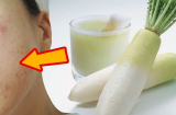 Củ cải không chỉ để nấu các món ngon mà còn có tác dụng chữa bệnh thần kỳ có thể bạn chưa biết
