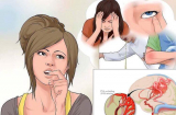 Thấy bạn bè người thân có dấu hiệu này trong lúc ăn cơm hãy đưa họ đi viện gấp coi chừng xuất huyết não