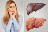 3 cách 'dễ như ăn kẹo' giúp bạn thải độc tố ra khỏi Sh88bet đăng ký miễn phí đơn giản nhất ai cũng làm được