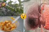 Thực phẩm chữa được bệnh lao phổi rất hiệu nghiệm, Việt Nam có đầy nhưng lại bị bỏ quên