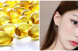 Kết hợp vitamin E với thứ này Mừng SHBET phiên bản mới 2025 sẽ hết sạch mụn thâm, dầu nhờn lại trắng hồng chỉ sau đúng một tuần