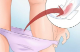 5 sai lầm trầm trọng chị em hay mắc phải khi sử dụng băng vệ sinh trong ngày đèn đỏ, nhất là số 1