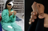 Xâm hại 'cái ngàn vàng' của nữ sinh lớp 10 bất thành, 'yêu râu xanh” đánh mù mắt nạn nhân