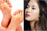 6 kiểu nốt ruồi may mắn, mở đường cho QUÝ NHÂN phù trợ suốt đời, người sở hữu nó tha hồ hưởng lộc