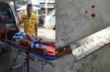 Cuồng ghen, vợ cắt phăng 'của quý' của chồng khi đang ngủ