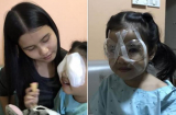 Chỉ vì cha làm điều này khi cho con ăn cơm mà bé gái 4 tuổi phải đi Shbet888 tiền thưởng cực khủng mắt