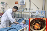Ngộ độc khí than, 1 người tử vong 4 người nhập viện - lời cảnh báo của chuyên gia đến mọi người khi nấu