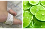 Con sốt cao mẹ hãy cắt ngay vài lát chanh mỏng đắp lên chỗ này đảm bảo khỏi ngay