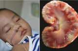 Mới 10 tuổi tử vong vì mắc bệnh ung thư thận, nguyên nhân do cha mẹ hay cho ăn món cực phổ biến này