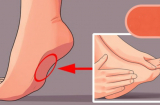 Vị trí quan trọng dưỡng và thải độc cho gan, thận… nhưng đang bị đối xử 'ngược đãi' nhất trên Sh88bet đăng ký miễn phí