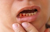 Khi bị thế này hãy đi khám ngay kẻo mất mạng vì ung thư, bệnh gan thận lúc nào chẳng hay