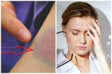 Thấy có dấu hiệu này, hãy đến bệnh viện kiểm tra ngay lập tức kẻo hối hận không kịp