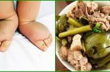 Bé gái 3 tuổi đi không nổi vì bệnh gout do thường xuyên được ông bà cho ăn món quen thuộc này