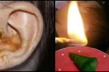 Sai lầm nhiều người mắc khi trị viêm tai giữa cho con, cha mẹ cần tránh ngay kẻo hối hận chẳng kịp