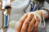 Cô gái trẻ suýt tử vong do phình mạch máu não vì bỏ qua dấu hiệu này khi đau đầu
