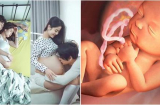 Bố làm điều đơn giản này nhưng sẽ giúp thai nhi hạnh phúc, xinh xắn hết phần người khác cực thông minh