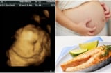Thai nhi bị SUY NÃO, ảnh hưởng đến hệ thần kinh nếu mẹ ăn cá kiểu này