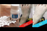 Nghiền nát 10 viên vitamin B1 trộn đều sữa chua để tắm, da đen xì cũng trắng bóc sau 2 tuần
