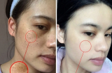 Đẩy lùi nám, tàn nhang ngay tại nhà không khó như bạn nghĩ, hãy xem ngay kẻo lại hối hận