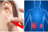 Ông cha ta đã dạy: ‘Thận có khỏe thì sức mới bền’ nên hãy nhớ kĩ 6 cách chăm sóc thận đơn giản này