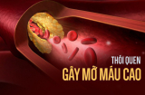 Vì thói quen này mà rất nhiều người Việt bị mỡ máu cao, dọn đường cho 'thần chết' tới nhanh hơn