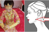 5 nốt ruồi 'cực phẩm' hiếm thấy ở phụ nữ, chỉ cần có 1 là sung sướng hơn người khác trăm lần