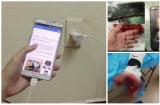 Lời cảnh tỉnh từ vụ việc tại Nam Định: Vừa sạc vừa dùng điện thoại, thiếu niên 17 tuổi bị nát lìa bàn tay