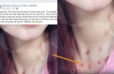 Thanh niên khóc hận phát hiện mình bị 'cắm sừng' khi nhờ dân mạng soi vết lạ trên cổ bạn gái yêu xa 10.000km