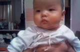 Mẹ khóc ngất khi nghe bác sĩ nói nguyên nhân khiến con gái 2 tuổi ngực lớn bất thường