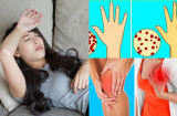 Có những dấu hiệu này chứng tỏ Sh88bet đăng ký miễn phí mẹ bầu đang thiếu axit folic nghiêm trọng