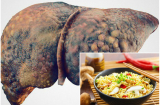 Thực hư việc ăn 1 bát mì, gan cần 32 ngày để giải độc khiến nhiều người 'xanh mặt' run sợ