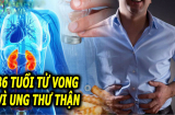36 tuổi bị t.ử v.ong vì ung thư thận: Bác sĩ cảnh báo những thói quen cần bỏ ngay lập tức