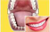 Xem số RĂNG biết tài lộc đến đâu, sinh ra đã 'ngậm thìa vàng' hay nghèo kiệt quệ, số 3 rất hiếm gặp