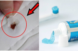 Chỉ mặt 5 món đồ thường hết hạn trước ngày đăng trên nhãn, cẩn thận ung thư gõ cửa