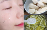 Muốn da trắng mịn nõn nà đón 8/3, hãy xông mặt bằng vỏ bưởi rồi chà đá sữa tươi lên da ngay còn kịp!