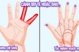 Dấu hiệu bàn tay cảnh báo căn bệnh vô cùng nguy hiểm rất nhiều người Việt vẫn cố tình bỏ qua