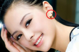 4 nốt ruồi BẠC TỶ, báo hiệu vận mệnh giàu sang, đại cát đại lợi chớ dại xóa đi
