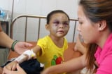 Cậu bé 6 tuổi xuất huyết não sau khi bị mẹ… tát: Cáu giận tới mấy cũng không đánh con ở vị trí này!