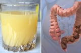 Bỏ ra 5 phút mỗi ngày lọc sạch ruột già chỉ trong một tuần theo đúng cách này, bạn sẽ vô cùng ngạc nhiên