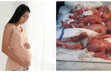Hy hữu 'chuyện ngàn năm mới gặp: Ca sinh thường 6 'thiên thần nhỏ' chỉ trong 9 phút, đến bác sĩ cũng trầm trồ