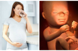 Mẹ khóc cạn nước mắt khi SINH CON DỊ TẬT, nguyên nhân do những thói quen thường ngày hầu hết mẹ bầu mắc phải