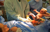 Mẹ sinh mổ bị chê... “không biết đẻ”: 7 điều đáng tự hào không phải ai cũng có, đặc biệt là số 4