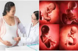 4 MỐC mẹ bầu buộc phải đi siêu âm để phát hiện 7 DỊ TẬT nghiêm trọng, mốc 1 nhiều người thường bỏ quên