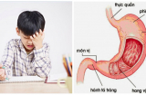 Cậu bé bị THỦNG DẠ DÀY, biết nguyên nhân khiến nhiều bố mẹ phải giật mình xem lại cách chăm con của mình