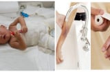 Cậu bé 17 tháng tuổi bỏng nước sôi, hành động sơ cứu của người mẹ đã giúp con thoát nạn trong gang tấc