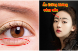 5 dấu hiệu xuất hiện trên mặt chính là điềm báo trước ĐẠI HỌA, nợ nần sắp ập tới bất ngờ