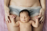 Sau sinh mổ nên ăn gì và kiêng ăn gì để nhanh liền sẹo, sữa về nhiều, da dẻ đẹp căng như con gái?